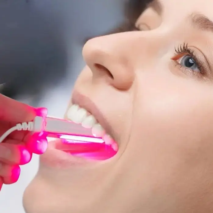 Red Light Therapy Device Cold Sore Canker Sore Treatment - Image 3